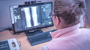Přímá digitalizace, rychlost, kvalita, to jsou hlavní výhody nového rentgenu na ortopedii Fakultní nemocnice Olomouc