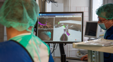 Plicní lékaře FN Olomouc naviguje při endoskopickém vyšetření 3D mapa až k plicnímu ložisku