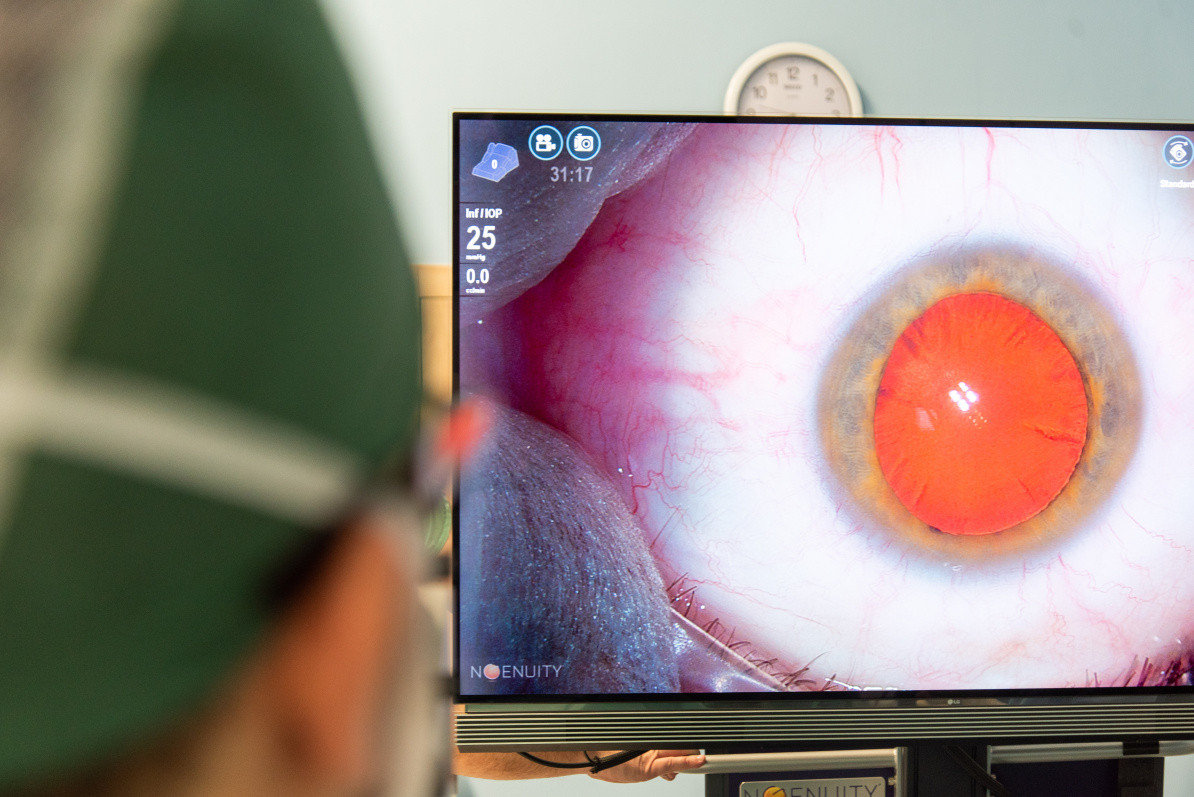 Oční klinika disponuje přístrojem NGenuity®3D.